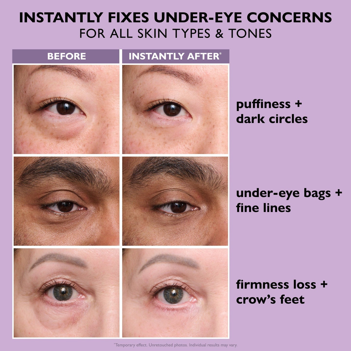 Instant FIRMx Eye Temporary Eye Tightener Easy-Wear Formula-Shop