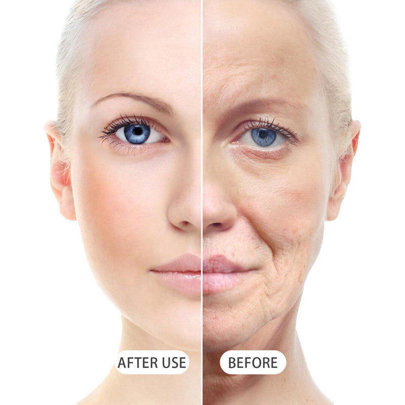 🐝💎 Botox Bee Venom Wrinkle Removal Cream 💎🐝-Shop