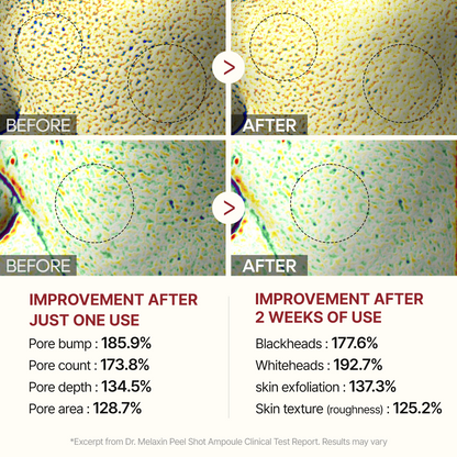 Peel Shot Glow White Rice Ampoule-Shop