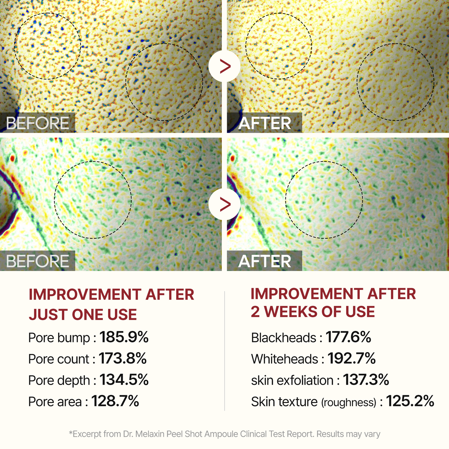 Peel Shot Glow Black Rice Ampoule-Shop