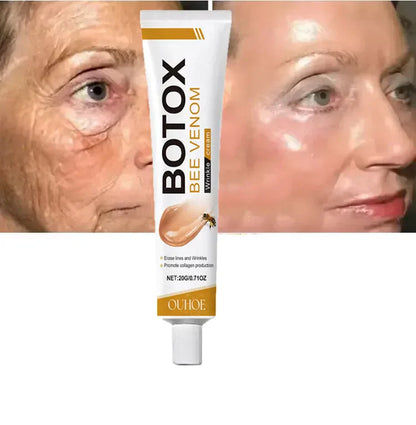 🐝💎 Botox Bee Venom Wrinkle Removal Cream 💎🐝-Shop
