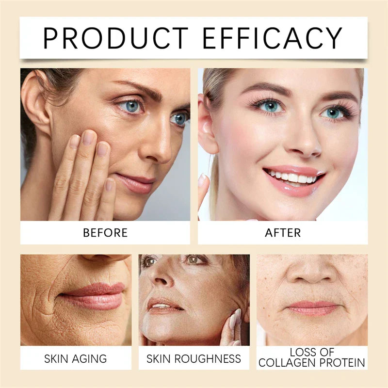 🐝💎 Botox Bee Venom Wrinkle Removal Cream 💎🐝-Shop