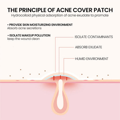 Pimple Patches,Pimple Patches For Face, Hydrocolloid Acne Patches, Cute Star Sti-Shop