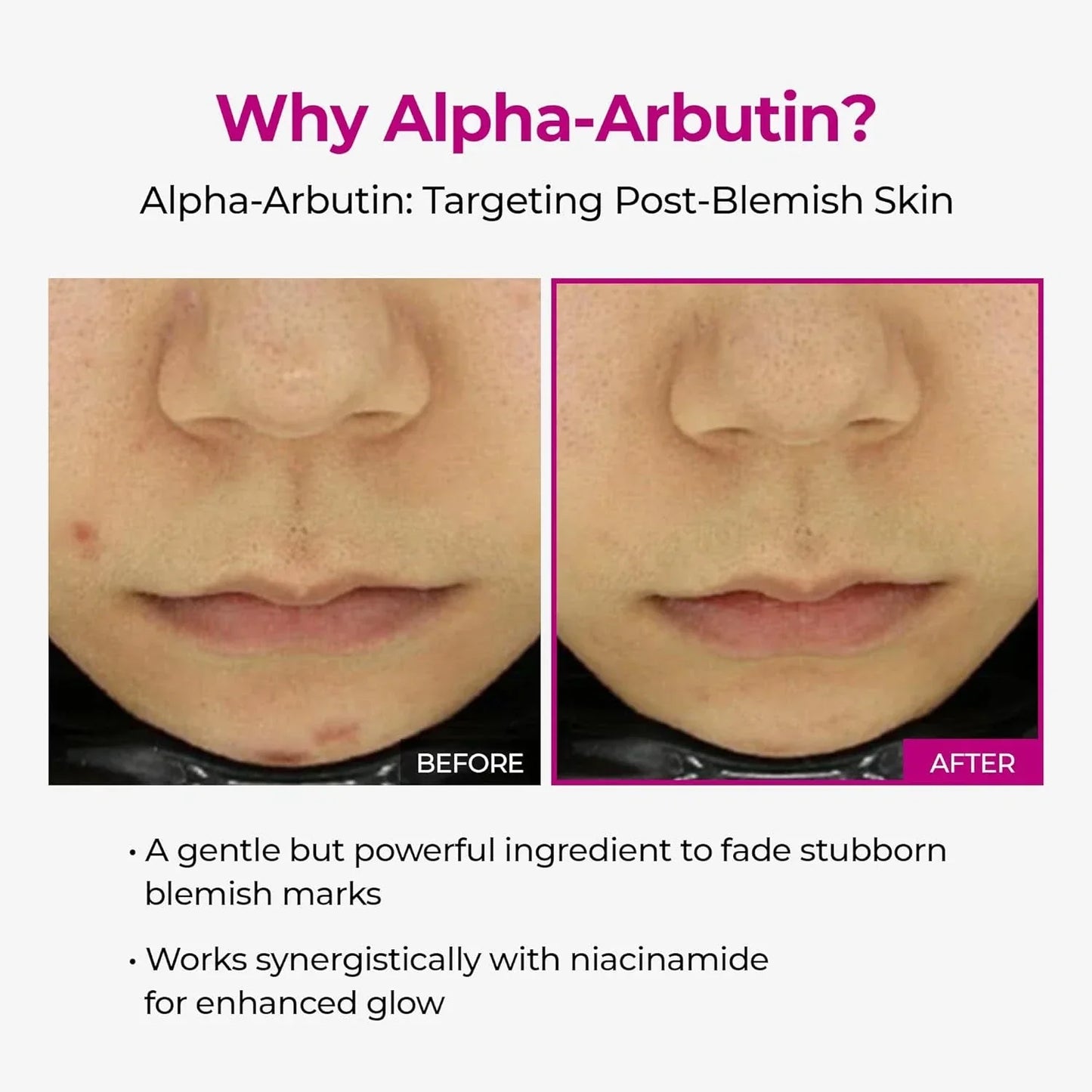 Dr.Melaxin Cemenrete Picotonic Shot Calcium Serum for Firming Density collagen s-Shop