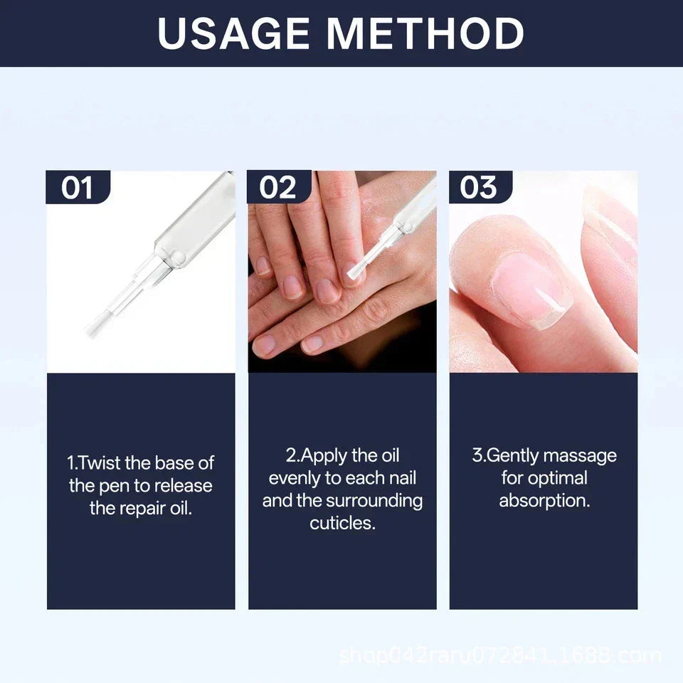 Lunavia Antifungal Pen – 25% Undecylenic Acid, Toenail Fungus Treatment Extra St-Shop