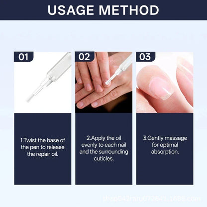 Lunavia Antifungal Pen – 25% Undecylenic Acid, Toenail Fungus Treatment Extra St-Shop