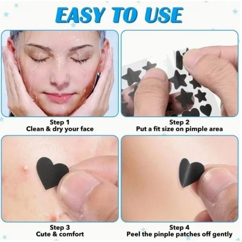 Pimple Patches for Face, 200 Pcs in 5 Sizes & Colors, Hydrocolloid Acne Treatmen-Shop